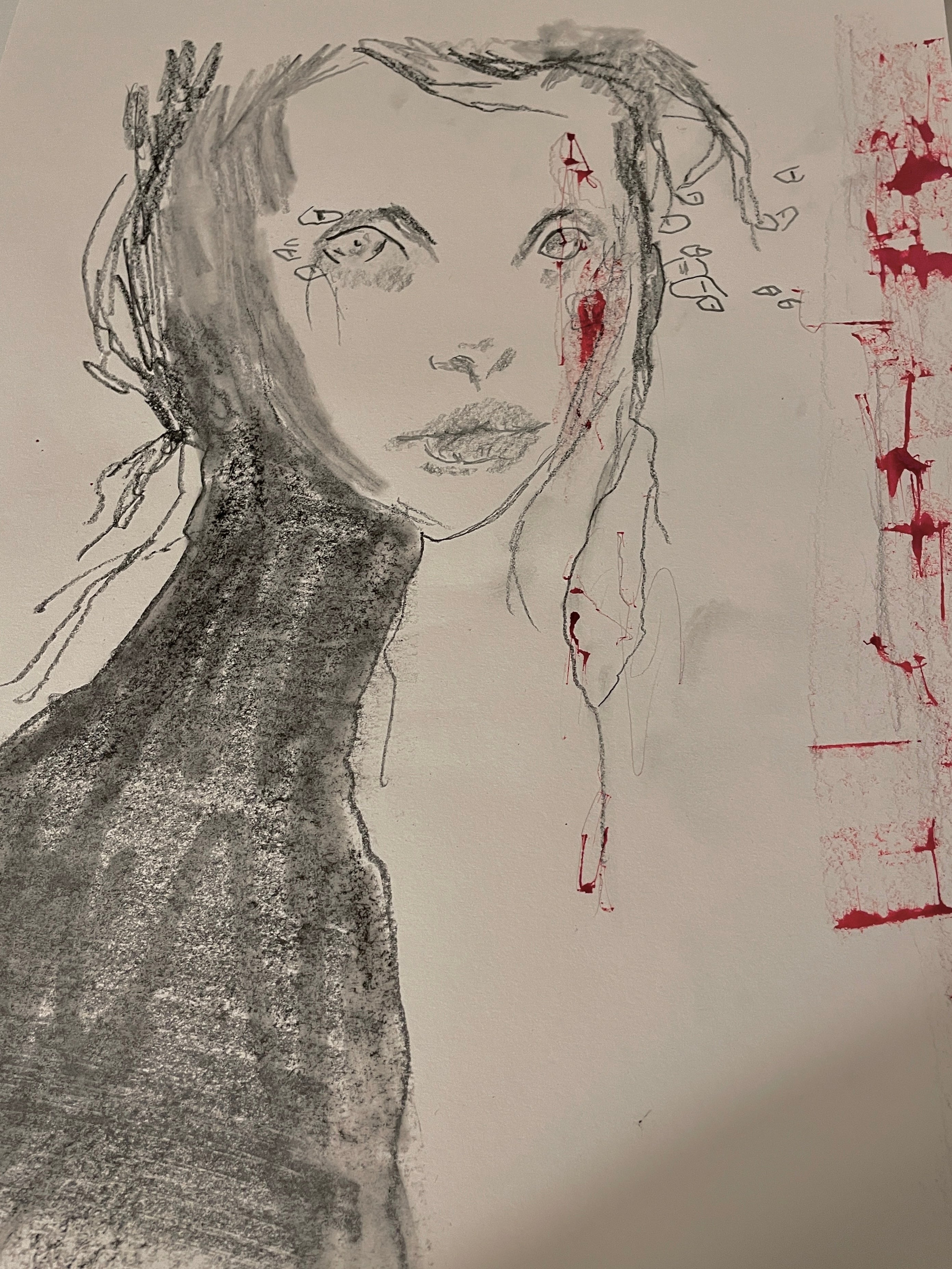 Pain